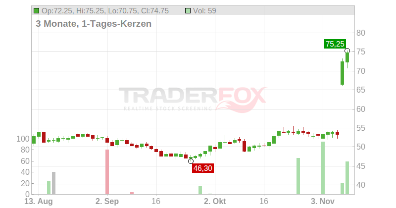 Globus Medical Chart